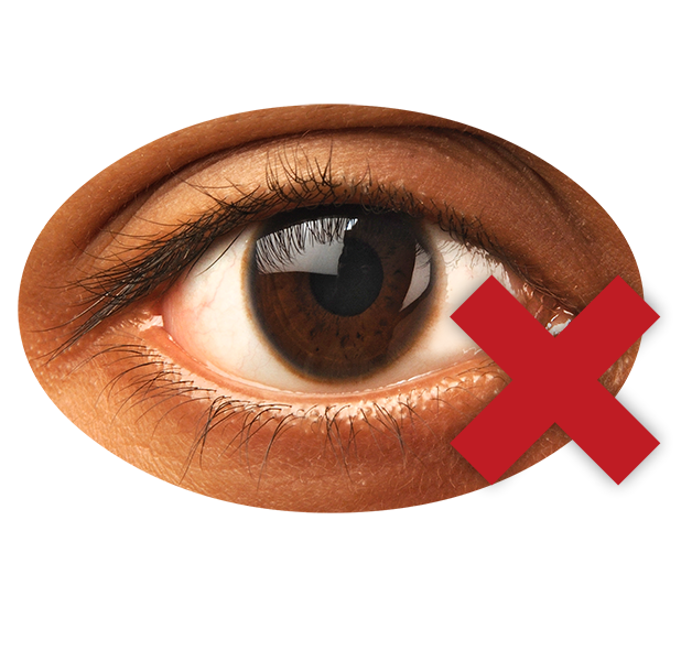 Eye with a red cross.